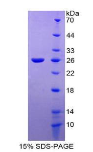 RPA125Hu01.jpg