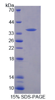 Recombinant Tyrosine Kinase With Immunoglobulin Like And EGF Like Domains Protein 1 (Tie1)