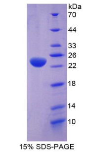 Recombinant TEK Tyrosine Kinase, Endothelial (Tie2)