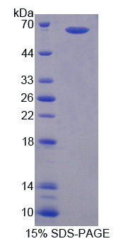 Recombinant TEK Tyrosine Kinase, Endothelial (Tie2)