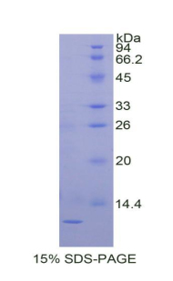 Recombinant Tissue Inhibitors Of Metalloproteinase 2 (TIMP2)