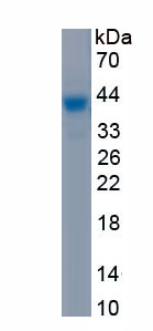 Recombinant Tissue Inhibitors Of Metalloproteinase 2 (TIMP2)