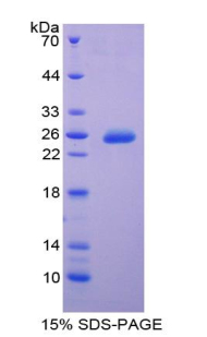 Recombinant Tissue Inhibitors Of Metalloproteinase 3 (TIMP3)