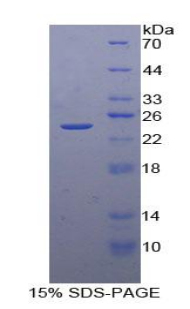 Recombinant Tissue Inhibitors Of Metalloproteinase 4 (TIMP4)