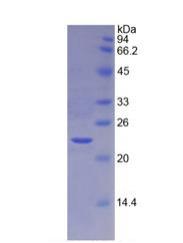 Recombinant Tissue Inhibitors Of Metalloproteinase 4 (TIMP4)