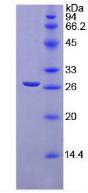 Recombinant Transforming Growth Factor Beta Induced Protein (TGFbI)