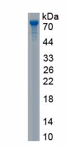 Recombinant Transforming Growth Factor Beta Induced Protein (TGFbI)