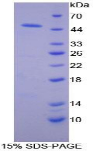 Recombinant Adiponectin Receptor 2 (ADIPOR2)