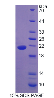 Recombinant Adiponectin Receptor 2 (ADIPOR2)