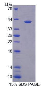 Recombinant Tumor Necrosis Factor Alpha (TNFa)