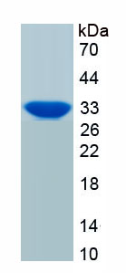 Recombinant Tumor Necrosis Factor Related Apoptosis Inducing Ligand (TRAIL)