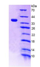 Recombinant Tumor Necrosis Factor Related Apoptosis Inducing Ligand (TRAIL)