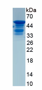 Recombinant Tumor Necrosis Factor Related Apoptosis Inducing Ligand (TRAIL)