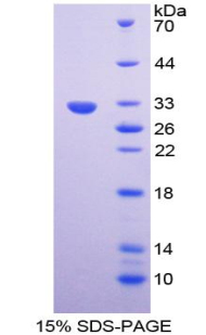 Recombinant Plasminogen Activator, Urokinase (uPA)