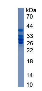 Recombinant Plasminogen Activator, Urokinase Receptor (uPAR)