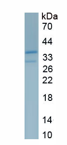 Recombinant Plasminogen Activator, Urokinase Receptor (uPAR)