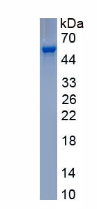 Recombinant Plasminogen Activator, Urokinase Receptor (uPAR)