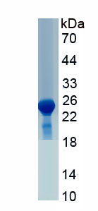 Recombinant Plasminogen Activator, Urokinase Receptor (uPAR)