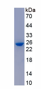 Recombinant Adiponectin Receptor 1 (ADIPOR1)