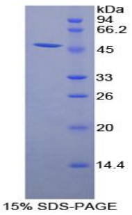 RPA147Hu01.jpg