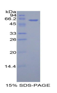 Recombinant Adiponectin Receptor 1 (ADIPOR1)