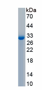 Recombinant Collagen Type IV Alpha 1 (COL4a1)