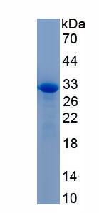 Recombinant Collagen Type IV Alpha 1 (COL4a1)