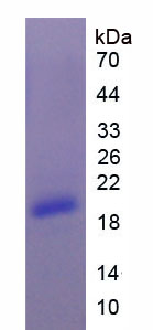 Recombinant Carcinoembryonic Antigen (CEA)