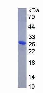 Recombinant Prostate Specific Antigen (PSA)