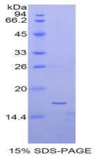 RPA153Hu01.jpg