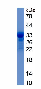 Recombinant Alpha-Fetoprotein (AFP)