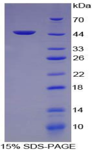 Recombinant Alpha-Fetoprotein (AFP)