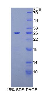 Recombinant Carbohydrate Antigen 125 (CA125)