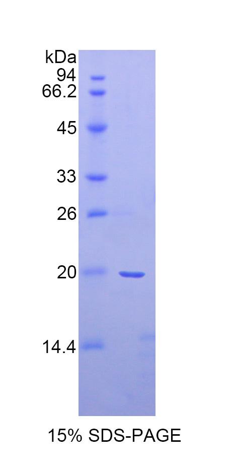 Recombinant Alpha 2-Antiplasmin (a2PI)