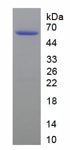 Recombinant Alpha 2-Antiplasmin (a2PI)