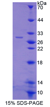 Recombinant Ubiquitin (Ub)