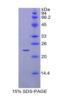 Recombinant Glucosidase Alpha, Acid (GaA)