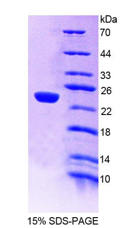 Recombinant Glucosidase Alpha, Acid (GaA)