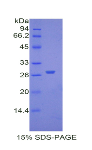 Recombinant Alpha-2-Heremans Schmid Glycoprotein (AHSG)