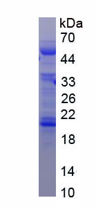 Recombinant Alpha-2-Heremans Schmid Glycoprotein (AHSG)