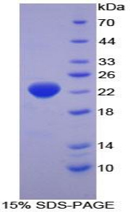 RPA179Hu01.jpg
