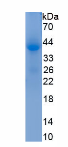 Recombinant Neutrophil Elastase (NE)