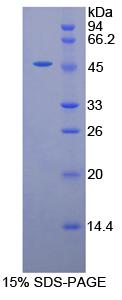 Recombinant Galactosidase Alpha (GLa)