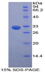 Recombinant Galactosidase Alpha (GLa)