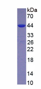 Recombinant Galactosidase Alpha (GLa)