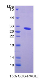 Recombinant Galactosidase Alpha (GLa)