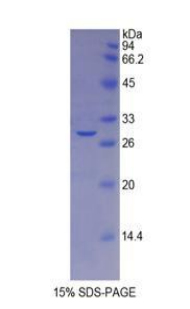 Recombinant Galactosidase Beta (GLb)