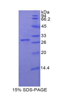 Recombinant Galactosidase Beta (GLb)