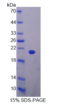 Recombinant Glycoprotein IX, Platelet (GP9)