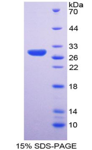 RPA198Hu01.jpg